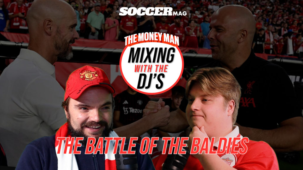 Watch: The battle of the Baldies